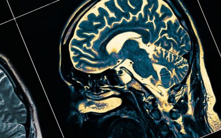 Neurocientífica descubre lo que pasa en el cerebro antes de morir