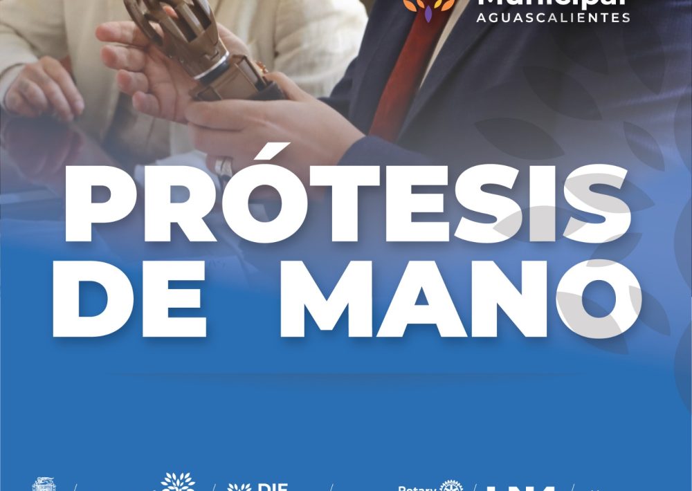 DIF MUNICIPAL Y ROTARY AGUASCALIENTES REALIZARÁN DONACIÓN DE PRÓTESIS DE MANO